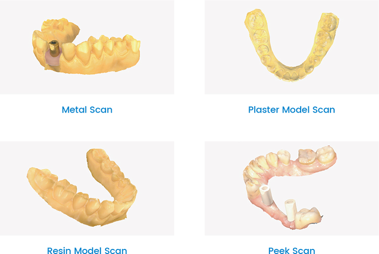 Rapid 3 Intraoral Scanner